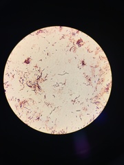 Bacillus subtilis