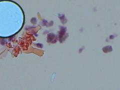 Botryobasidium subcoronatum