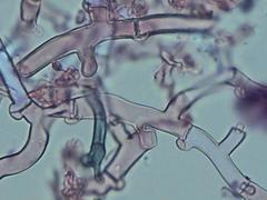 Botryobasidium subcoronatum