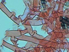 Botryobasidium subcoronatum