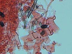 Botryobasidium subcoronatum