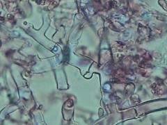 Botryobasidium subcoronatum