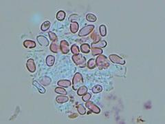 Botryobasidium subcoronatum