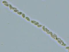 Botryobasidium subcoronatum