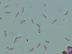 Botryobasidium subcoronatum