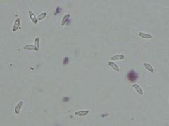 Botryobasidium subcoronatum