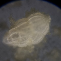 Uvigerinidae