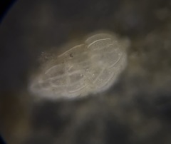 Uvigerinidae