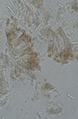 Nesolechia oxyspora
