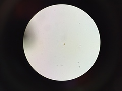 Chrysococcus