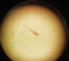 Puccinia graminis