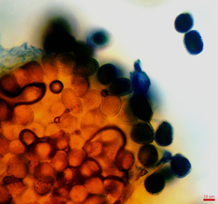 Coleosporium vernoniae