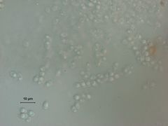Rhizopogon alexsmithii