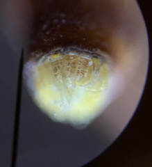 Pohlia longibracteata