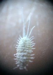 Pseudococcus viburni