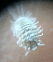Pseudococcus viburni