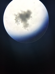 Aspergillus