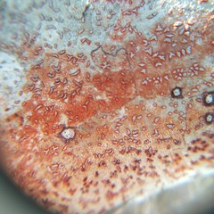 Arthonia rubrocincta