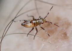 Deraeocoris flavilinea