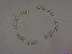 Dictyosphaerium