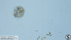 Vorticella campanula