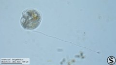 Vorticella campanula