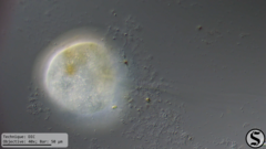 Vorticella campanula