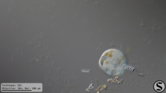 Vorticella campanula