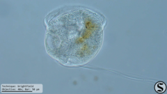 Vorticella campanula