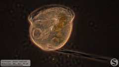 Vorticella campanula