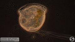 Vorticella campanula