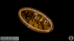 Surirella undulata