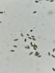 Truncatella conorum-piceae