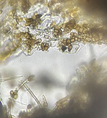 Truncatella conorum-piceae