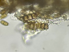 Truncatella conorum-piceae