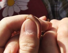 Xerotyphlops vermicularis