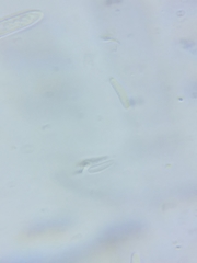 Lachnaceae