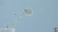 Cochliopodium