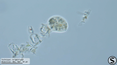 Cochliopodium