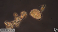 Cochliopodium