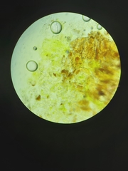 Chaenotheca trichialis