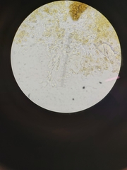 Chaenotheca trichialis