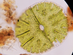 Micrasterias denticulata