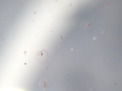 Noctiluca scintillans