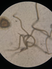 Reboulia hemisphaerica