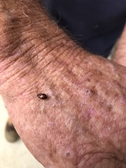 Hippodamia variegata