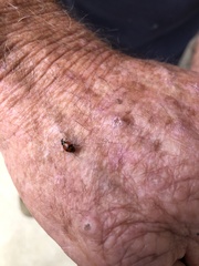 Hippodamia variegata