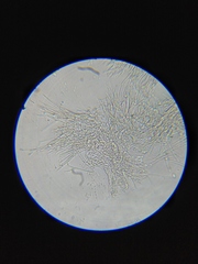 Stilbella fimetaria