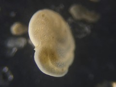Cibicidoides wuellerstorfi