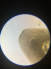 Macrostomum